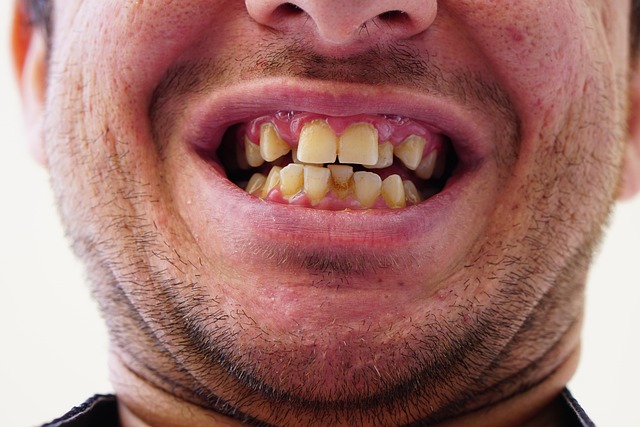 Detaljer om invisalign priser og hvad du betaler for
